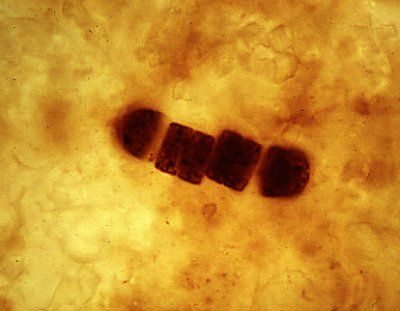Zyanobakterien-Fossilien